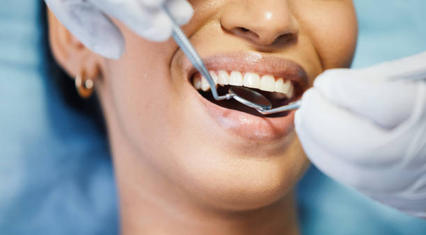 Best Emergency Gum Treatment in Moss Point, MS
